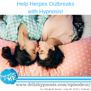 decrease herpes outbreaks with hypnosis